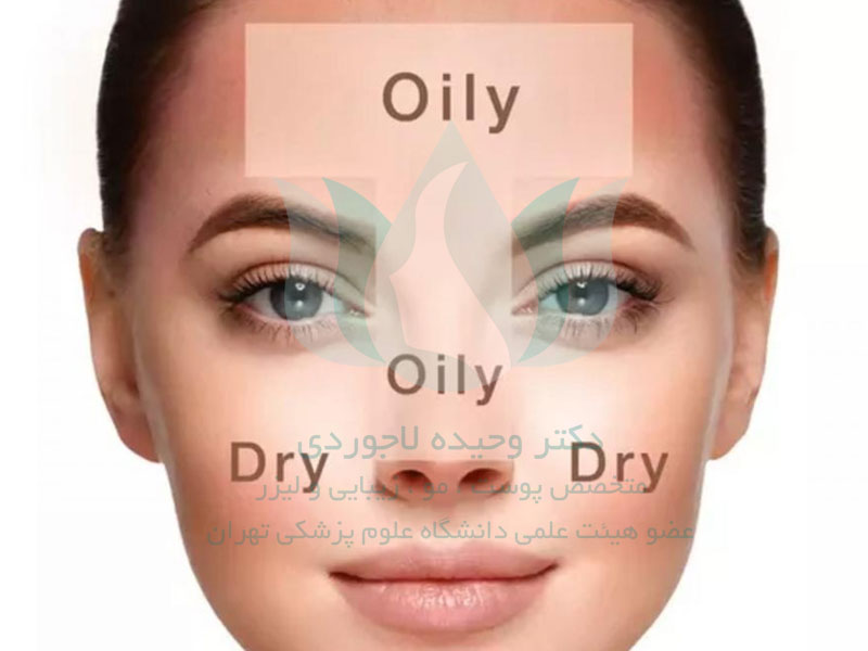 مراقبت از پوست خشک و چرب